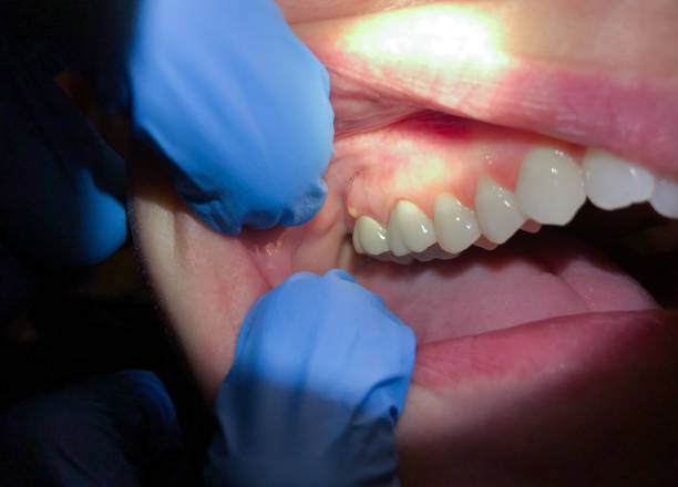 Best Dentist Open Late Near Me  in Wrightsville, GA